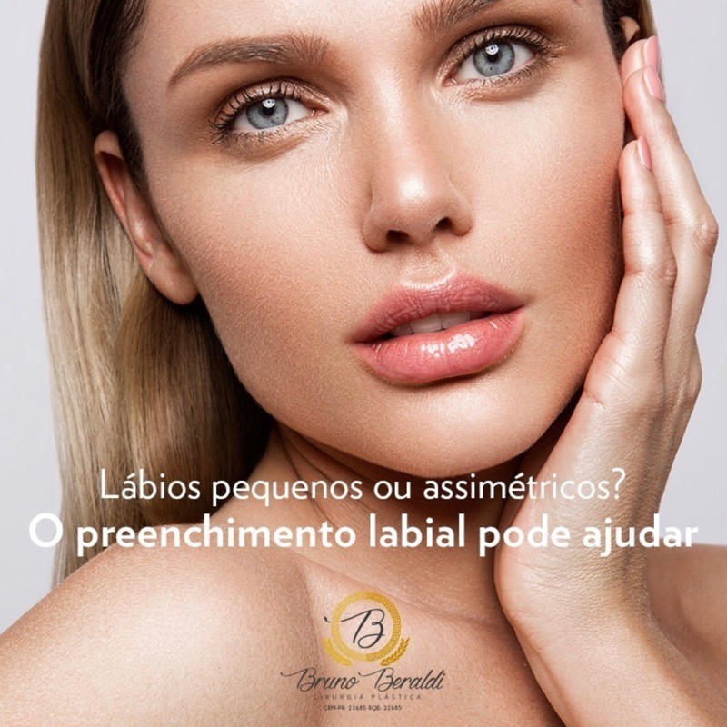 Em busca dos lábios dos sonhos: Preenchimento Labial